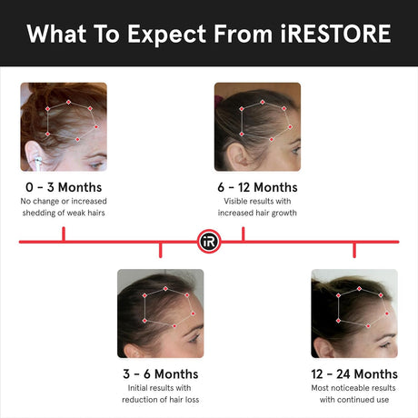 iRestore Essential Laser Hair Growth System + Rechargeable Battery Pack